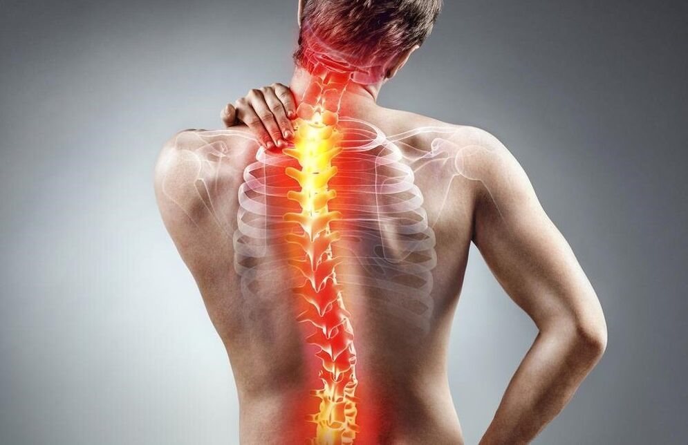 la schiena fa male con l'osteocondrosi