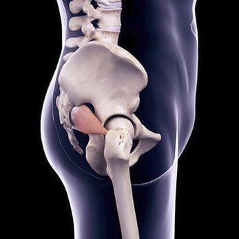 Il dolore alla schiena del pugnale può essere dovuto allo spasmo del muscolo piriforme