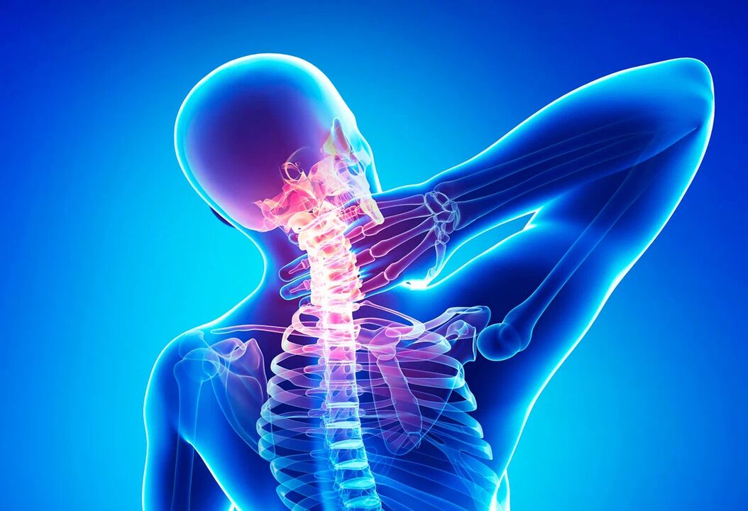 L'osteocondrosi della colonna vertebrale è una malattia comune che richiede un trattamento. 