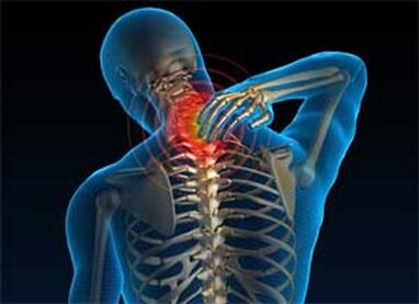Il dolore al collo è un sintomo comune di osteocondosi