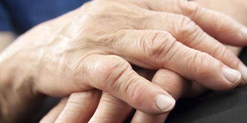 In quali patologie fanno male le articolazioni delle dita